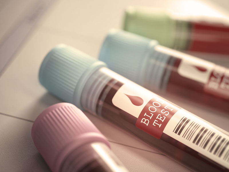 blood test vial